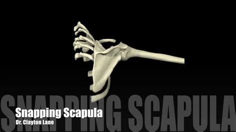 Snapping Scapula Syndrome Youtube