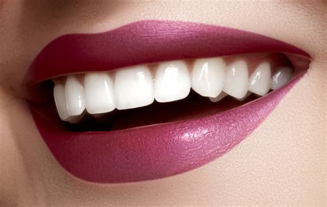 Dise O De Sonrisa Te Explicamos El Paso A Paso Estudi Dental Barcelona