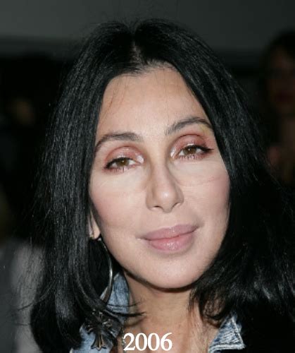 Her career as a singer is reaching more than 50 years now. Cher Plastic Surgery Before and After Photos