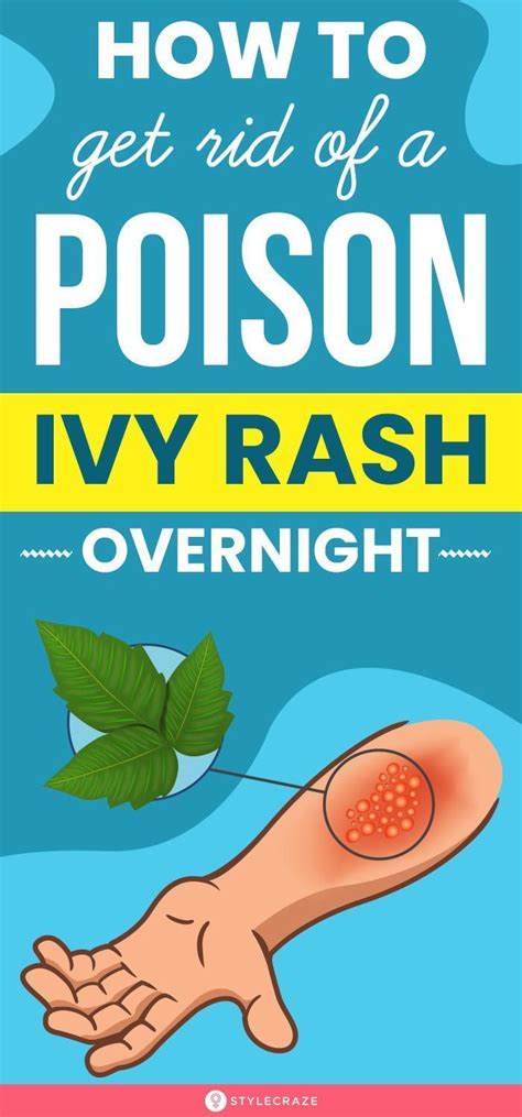 How To Get Rid Of A Poison Ivy Rash Overnight Poison Ivy Rash Poison