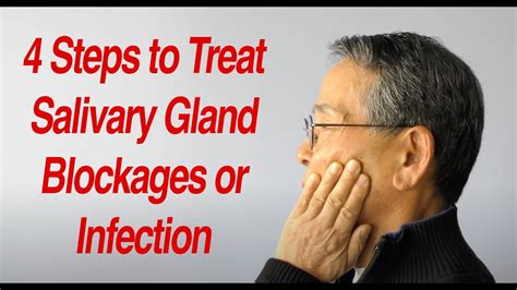 4 Steps To Treat Salivary Gland Swelling At Home Youtube