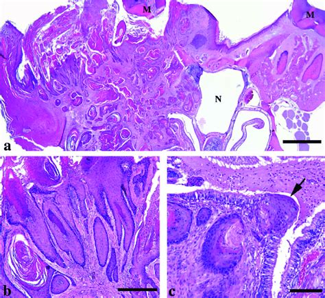 Squamous Cell Carcinoma Scc In Tcdd Treated Rats 100 Ngkg Core