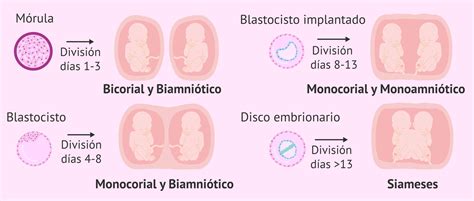 ¿qué Diferencia El Embarazo De Gemelos Del Embarazo De Mellizos