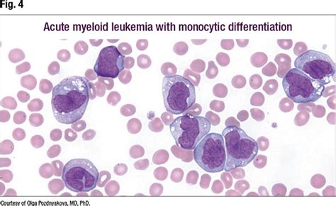 Difference Between Monocytes And Lymphocytes