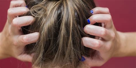10 Reasons Your Scalp Might Be Itchy — And What To Do About It Scalp