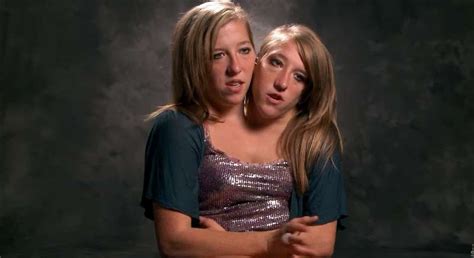 conjoined twins share huge news 22 years after their birth the delite