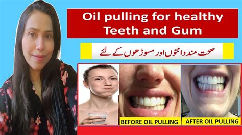 Oil Pulling For Healthy Teeth And Gums Oil Pulling For Total Body