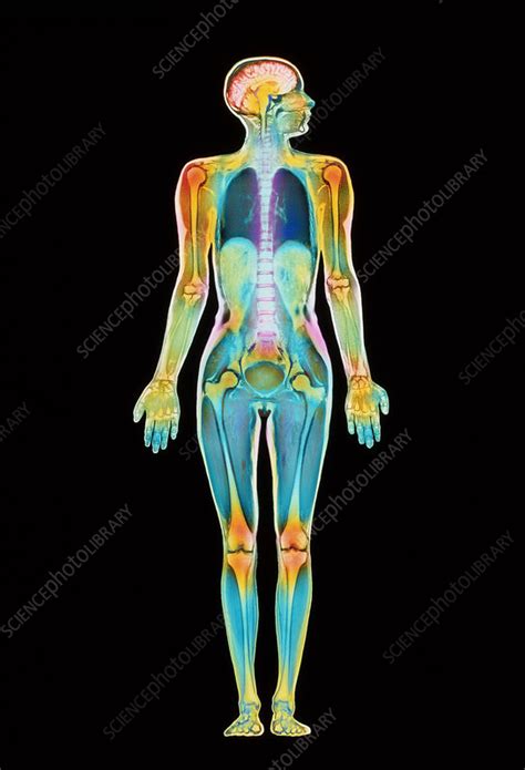 Coloured Mri Scan Of A Whole Human Body Female Stock Image P835