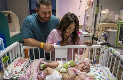 Conjoined Twins Survived A Rare Surgery Now Theyre Going Home