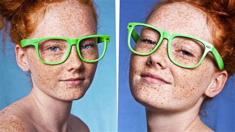 21 Things Only Freckled People Will Understand Affiliate Demo