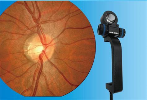Fundus Retinal Viewing System For Slit Lamp New Vision Meditec Co Ltd