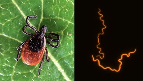 Breakthrough Paves Way For New Lyme Disease Treatment Alternative