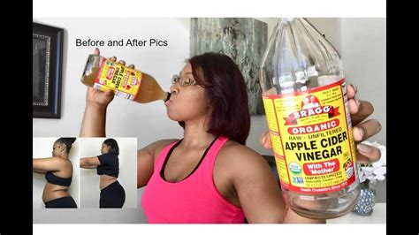 Drinking Apple Cider Vinegar Lose Weight Fast Youtube
