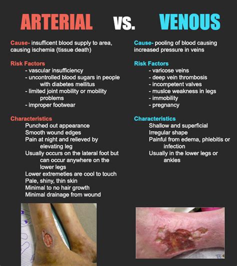 Unlike venous ulcers, arterial ulcers are often dry due to minimal drainage. Arterial vs Venous Ulcers - NCLEX Quiz