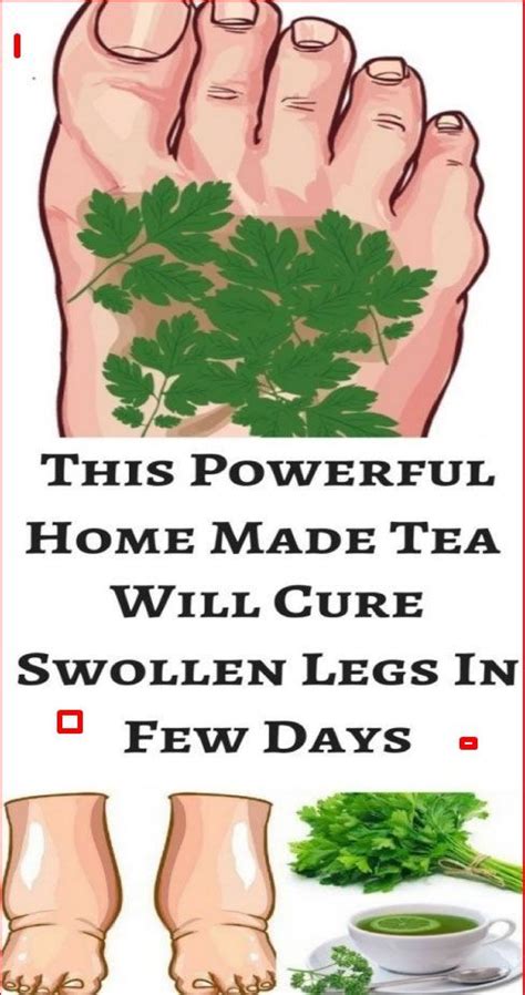This Powerful Homemade Tea Will Cureswollen Legs In Few Days Swollen