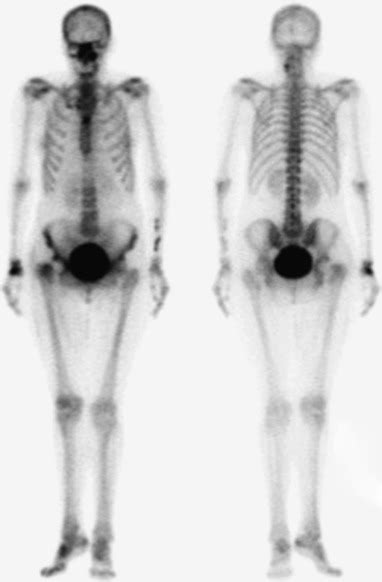 The basic science of nuclear medicine - Orthopaedics and Trauma