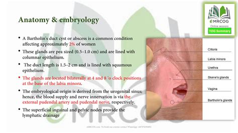 Cisto De Bartholin é Grave