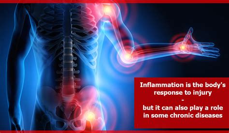 Inflammation Is The Bodys Response To Injury But It Can Also Play A