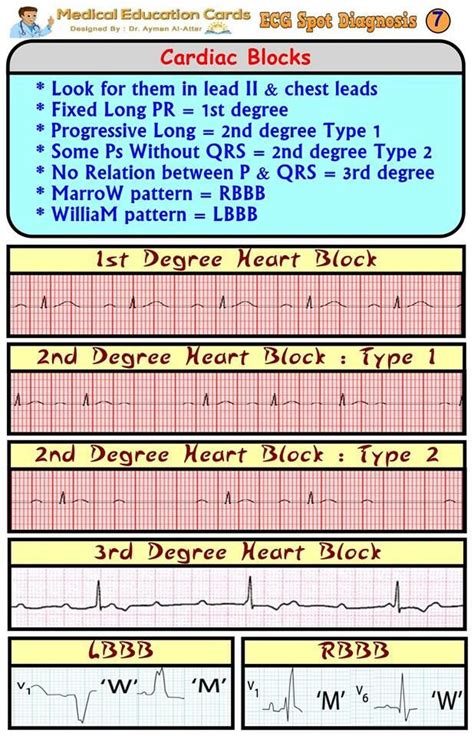 Cardiac Ekg Interpretation Nursing Cardiac Nursing Cardiac Rhythms