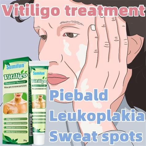 Hot Sale Quick Results White Spot Cream Vitiligo Rash Cream Chinese