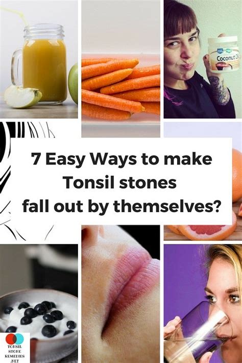 How To Make Tonsil Stones Fall Out By Themselves The 7 Easy Ways