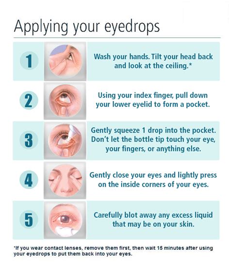 How To Apply Eye Drops And Eye Ointments