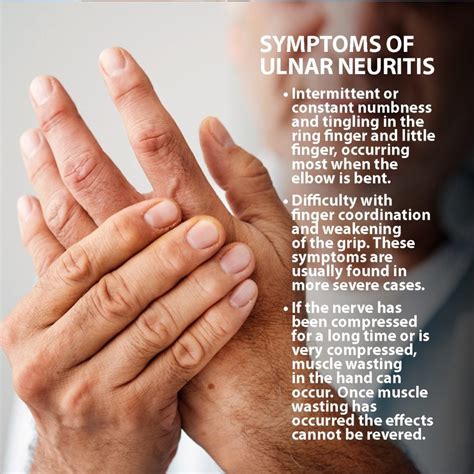 Ulnar Neuritis Information Florida Orthopaedic Institute