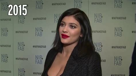 Inside Kylie Jenners £30k Body Overhaul As Surgeon Explains