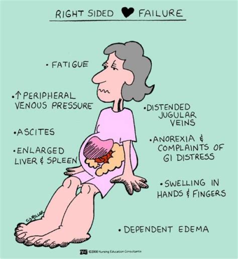 Congestive heart failure is a chronic complex clinical syndrome which prevents filling or emptying of blood from the heart. Why can congestive heart failure lead to edema? - Quora