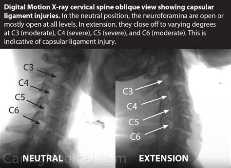 Reviews Of Diagnostic Imaging Technology For Cervical Spine Instability