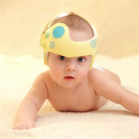 Torticollis Plagiocephaly Brachiocephaly And Cranial Bands Oh My