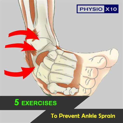 5 Strengthening Exercises To Prevent Ankle Sprain Physio X10