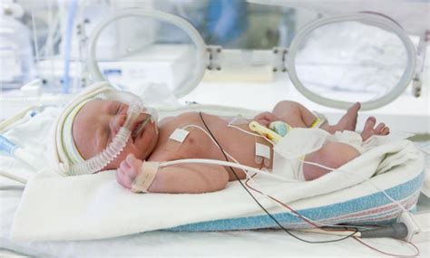 Taking Care Of A Premature Baby Kempton Express