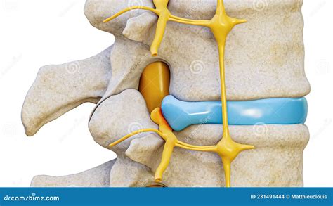 Herniated Disc With Spinal Nerve Compression 3d Rendering Illustration