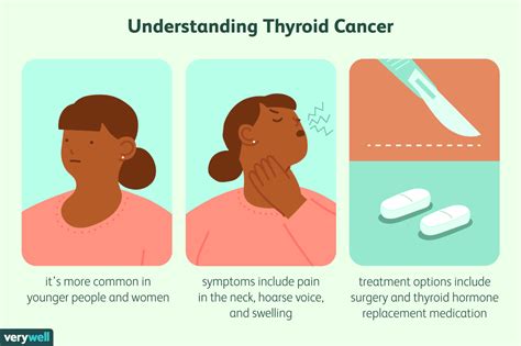 Thyroid Cancer Overview And More