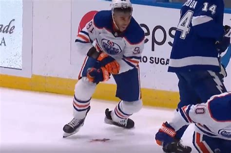 Oilers Evander Kane Leaves Ice After Wrist Sliced On Skate In Bloody Scene