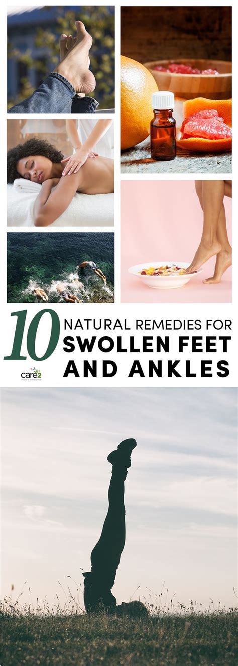 10 Natural Remedies For Swollen Feet And Ankles Foot Remedies