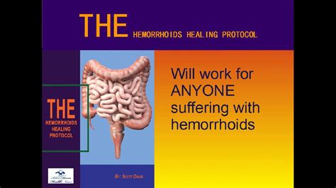 the hemorrhoids healing protocol youtube