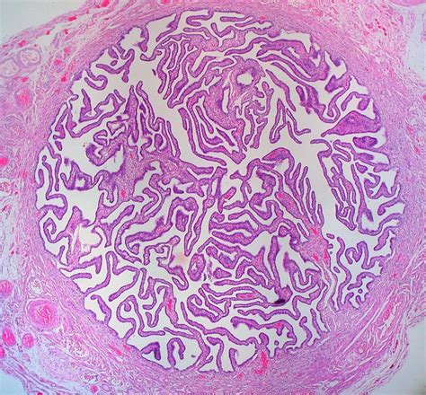 Histology Of Fallopian Tube Medizzy