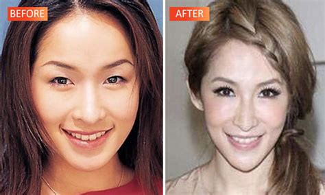 Did Taiwans Elva Hsiao Have Plastic Surgery Check Out Her Drastic