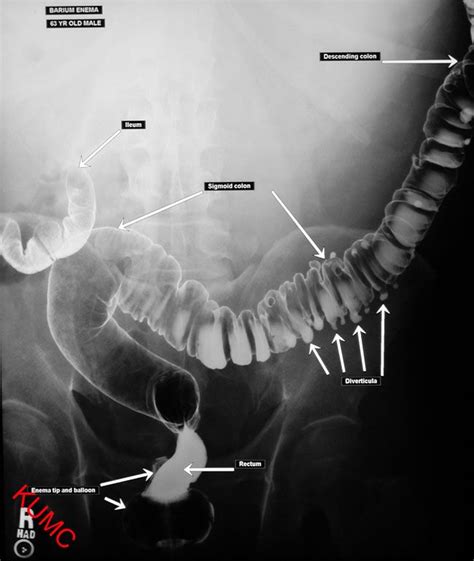 Pin By Jeremy Enfinger On Radiographic Anatomy Radiology Student Radiology Radiology Schools