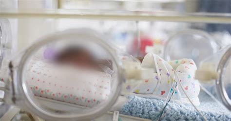 Bebé Prematuro Fue Declarado Muerto En Dos Ocasiones Lo Escucharon