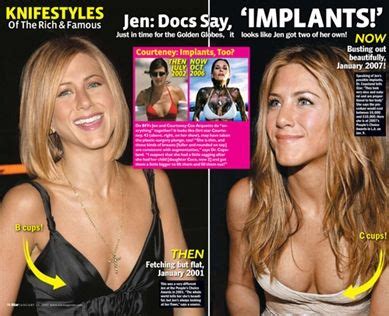Jennifer Aniston Plastic Surgery Breast Implants Before And After Nose Job Star Plastic