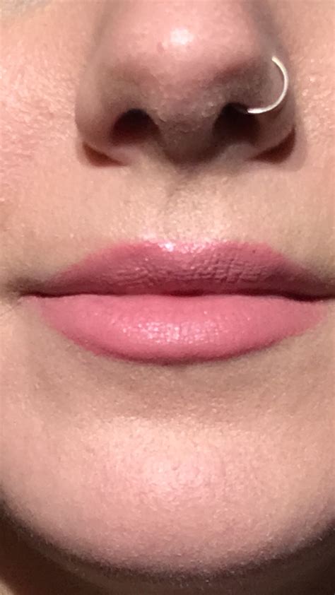 bumps on lips after kissing qqmcuo