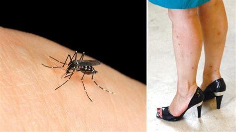 Malta Under Attack From Mosquitoes