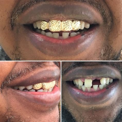 To communicate or ask something with the place, the phone number is (786). Gold Grillz Miami