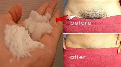 How To Remove Pubic Hair Permanently Naturally In Minutes YouTube