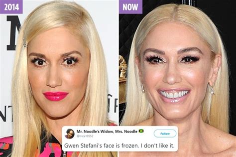 Gwen Stefani 50 Accused Of Getting Plastic Surgery As She Looks ‘frozen’ And ‘unrecognizable