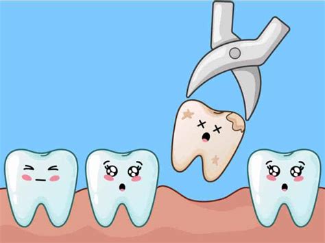 Tooth Extraction Stages Of Healing