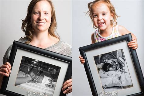 Then And Now Photos Show Amazing Resilience Of Premature Babies